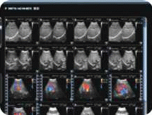 迈瑞吧 什么品牌彩超好，什么品牌B超好？